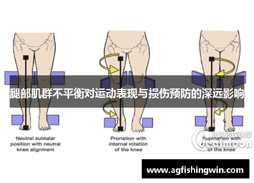 腿部肌群不平衡对运动表现与损伤预防的深远影响